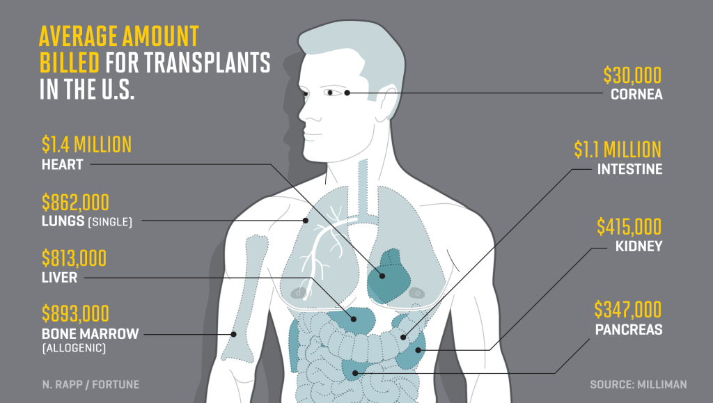 Infographic of average amounts billed for organ transplants in the U.S.